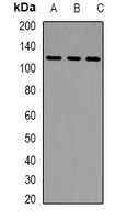 LLGL2 Antibody - Western blot analysis of LLGL2 expression in HepG2 (A); mouse lung (B); mouse testis (C) whole cell lysates.