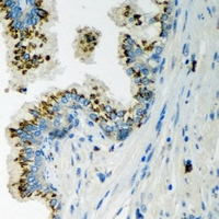 LLGL2 Antibody - Immunohistochemical analysis of LLGL2 staining in human prostate formalin fixed paraffin embedded tissue section. The section was pre-treated using heat mediated antigen retrieval with sodium citrate buffer (pH 6.0). The section was then incubated with the antibody at room temperature and detected using an HRP conjugated compact polymer system. DAB was used as the chromogen. The section was then counterstained with hematoxylin and mounted with DPX.