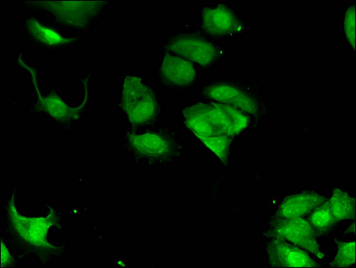 LLGL2 Antibody - Immunofluorescent analysis of MCF-7 cells using LLGL2 Antibody at a dilution of 1:100 and Alexa Fluor 488-congugated AffiniPure Goat Anti-Rabbit IgG(H+L)
