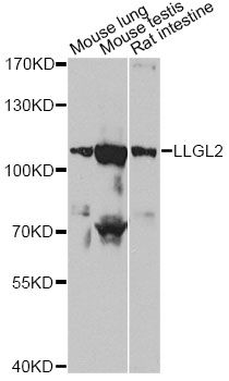 LLGL2 Antibody - Western blot analysis of extracts of various cell lines, using LLGL2 antibody at 1:1000 dilution. The secondary antibody used was an HRP Goat Anti-Rabbit IgG (H+L) at 1:10000 dilution. Lysates were loaded 25ug per lane and 3% nonfat dry milk in TBST was used for blocking. An ECL Kit was used for detection and the exposure time was 60s.