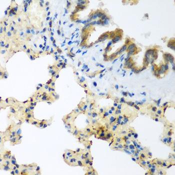 LLGL2 Antibody - Immunohistochemistry of paraffin-embedded Rat lung using LLGL2 Polyclonal Antibody at dilution of 1:200 (40x lens).