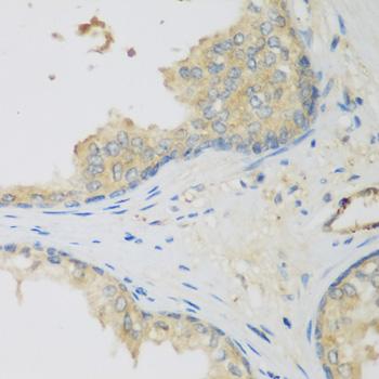 LLGL2 Antibody - Immunohistochemistry of paraffin-embedded Human prostate using LLGL2 Polyclonal Antibody at dilution of 1:200 (40x lens).
