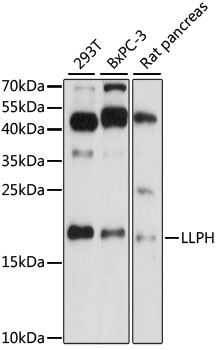 LLPH / C12orf31 Antibody - Western blot analysis of extracts of various cell lines, using LLPH antibody at 1:1000 dilution. The secondary antibody used was an HRP Goat Anti-Rabbit IgG (H+L) at 1:10000 dilution. Lysates were loaded 25ug per lane and 3% nonfat dry milk in TBST was used for blocking. An ECL Kit was used for detection and the exposure time was 90s.