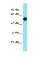 LMAN1L Antibody - Western blot of Human Fetal Brain. LMAN1L antibody dilution 1.0 ug/ml.  This image was taken for the unconjugated form of this product. Other forms have not been tested.