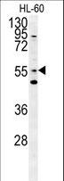 LMAN1L Antibody - LMA1L Antibody western blot of HL-60 cell line lysates (15 ug/lane). The LMA1L antibody detected the LMA1L protein (arrow).
