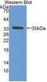 LMAN2 / VIP36 Antibody - Western blot of LMAN2 / VIP36 antibody.