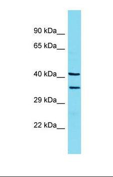 LMAN2 / VIP36 Antibody - Western blot of Rat Lung. Lman2 antibody dilution 1.0 ug/ml.  This image was taken for the unconjugated form of this product. Other forms have not been tested.