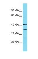 LMAN2 / VIP36 Antibody - Western blot of Rat Lung. Lman2 antibody dilution 1.0 ug/ml.  This image was taken for the unconjugated form of this product. Other forms have not been tested.