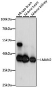 LMAN2 / VIP36 Antibody - Western blot analysis of extracts of various cell lines, using LMAN2 antibody at 1:1000 dilution. The secondary antibody used was an HRP Goat Anti-Rabbit IgG (H+L) at 1:10000 dilution. Lysates were loaded 25ug per lane and 3% nonfat dry milk in TBST was used for blocking. An ECL Kit was used for detection and the exposure time was 1s.