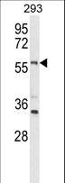 LMBR1L Antibody - Western blot of LMBR1L Antibody in 293 cell line lysates (35 ug/lane). LMBR1L (arrow) was detected using the purified antibody.