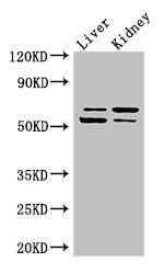 LMBRD1 Antibody - Western Blot Positive WB detected in: Mouse liver tissue, Mouse kidney tissue All lanes: LMBRD1 antibody at 4µg/ml Secondary Goat polyclonal to rabbit IgG at 1/50000 dilution Predicted band size: 62, 45, 54, 22 kDa Observed band size: 62, 54 kDa