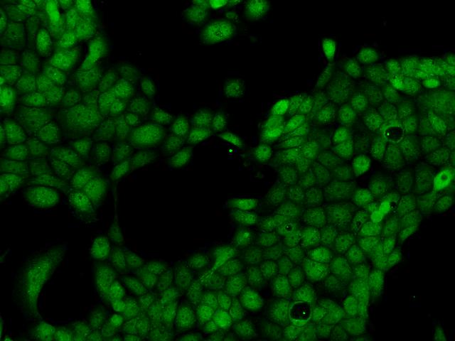 LMBRD2 Antibody - Immunofluorescence staining of LMBRD2 in A431 cells. Cells were fixed with 4% PFA, permeabilzed with 0.1% Triton X-100 in PBS, blocked with 10% serum, and incubated with rabbit anti-Human LMBRD2 polyclonal antibody (dilution ratio 1:200) at 4°C overnight. Then cells were stained with the Alexa Fluor 488-conjugated Goat Anti-rabbit IgG secondary antibody (green). Positive staining was localized to Nucleus and Cytoplasm.