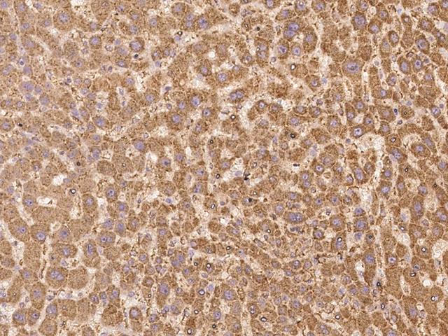 LMBRD2 Antibody - Immunochemical staining of human LMBRD2 in human liver with rabbit polyclonal antibody at 1:500 dilution, formalin-fixed paraffin embedded sections.