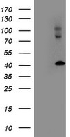 LMCD1 Antibody - HEK293T cells were transfected with the pCMV6-ENTRY control (Left lane) or pCMV6-ENTRY LMCD1 (Right lane) cDNA for 48 hrs and lysed. Equivalent amounts of cell lysates (5 ug per lane) were separated by SDS-PAGE and immunoblotted with anti-LMCD1.