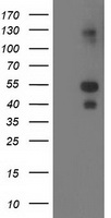 LMCD1 Antibody - HEK293T cells were transfected with the pCMV6-ENTRY control (Left lane) or pCMV6-ENTRY LMCD1 (Right lane) cDNA for 48 hrs and lysed. Equivalent amounts of cell lysates (5 ug per lane) were separated by SDS-PAGE and immunoblotted with anti-LMCD1.