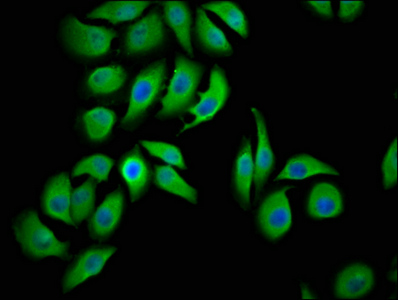 LMCD1 Antibody - Immunofluorescence staining of A549 cells at a dilution of 1:100, counter-stained with DAPI. The cells were fixed in 4% formaldehyde, permeabilized using 0.2% Triton X-100 and blocked in 10% normal Goat Serum. The cells were then incubated with the antibody overnight at 4 °C.The secondary antibody was Alexa Fluor 488-congugated AffiniPure Goat Anti-Rabbit IgG (H+L) .