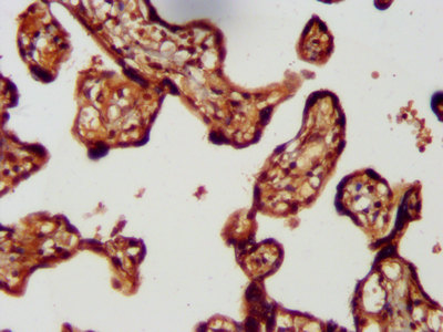 LMCD1 Antibody - Immunohistochemistry image at a dilution of 1:300 and staining in paraffin-embedded human placenta tissue performed on a Leica BondTM system. After dewaxing and hydration, antigen retrieval was mediated by high pressure in a citrate buffer (pH 6.0) . Section was blocked with 10% normal goat serum 30min at RT. Then primary antibody (1% BSA) was incubated at 4 °C overnight. The primary is detected by a biotinylated secondary antibody and visualized using an HRP conjugated SP system.