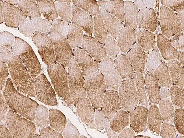 LMCD1 Antibody - Immunochemical staining of human LMCD1 in human skeletal muscle with rabbit polyclonal antibody at 1:500 dilution, formalin-fixed paraffin embedded sections.