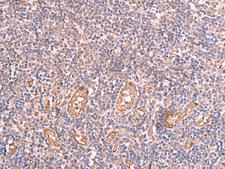 LMCD1 Antibody - Immunohistochemistry of paraffin-embedded Human tonsil tissue  using LMCD1 Polyclonal Antibody at dilution of 1:100(×200)