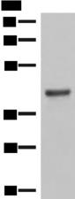 LMCD1 Antibody - Western blot analysis of Mouse lung tissue lysates  using LMCD1 Polyclonal Antibody at dilution of 1:550