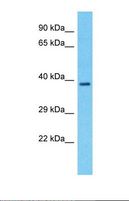 LMF1 Antibody - Western blot of Human Lung Tumor. LMF1 antibody dilution 1.0 ug/ml.  This image was taken for the unconjugated form of this product. Other forms have not been tested.