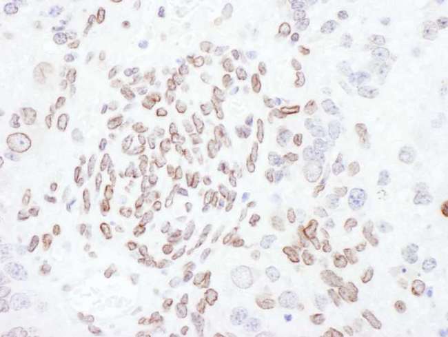 LMNA / Lamin A+C Antibody - Detection of Mouse Lamin-A /C by Immunohistochemistry. Sample: FFPE section of mouse teratoma. Antibody: Affinity purified rabbit anti-Lamin-A/C used at a dilution of 1:200 (1 ug/ml). Detection: DAB.