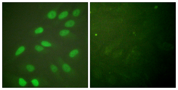 LMNA / Lamin A+C Antibody - Immunofluorescence analysis of HeLa cells, using Lamin A/C Antibody. The picture on the right is blocked with the synthesized peptide.