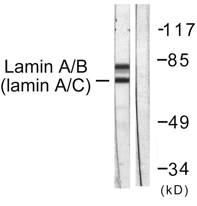 LMNA / Lamin A+C Antibody - Western blot analysis of lysates from HeLa cells, using Lamin A/C Antibody. The lane on the right is blocked with the synthesized peptide.