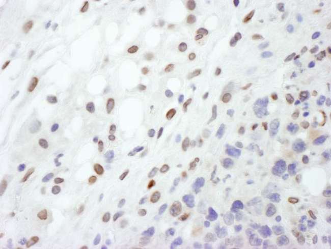 LMNA / Lamin A+C Antibody - Detection of Mouse Lamin-A by Immunohistochemistry. Sample: FFPE section of mouse plasmacytoma. Antibody: Affinity purified rabbit anti-Lamin-A used at a dilution of 1:200 (1 ug/ml). Detection: DAB.