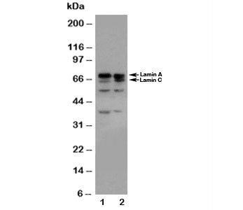 LMNA / Lamin A+C Antibody - Western blot testing of Lamin A/C antibody and Lane 1: HeLa; 2: A431 cell lysate
