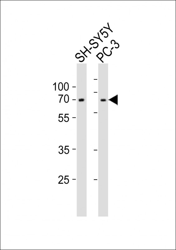 LMNA / Lamin A+C Antibody - All lanes : Anti-LMNA(Lamin-A/C) Antibody at 1:1000 dilution Lane 1: SH-SY5Y whole cell lysates Lane 2: PC-3 whole cell lysates Lysates/proteins at 20 ug per lane. Secondary Goat Anti-Rabbit IgG, (H+L), Peroxidase conjugated at 1/10000 dilution Predicted band size : 74 kDa Blocking/Dilution buffer: 5% NFDM/TBST.
