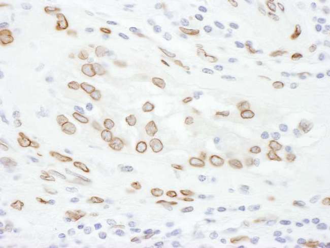 LMNA / Lamin A+C Antibody - Detection of Human Lamin-A by Immunohistochemistry. Sample: FFPE section of human testicular seminoma. Antibody: Affinity purified rabbit anti-Lamin-A used at a dilution of 1:1000 (0.2 ug/ml). Detection: DAB.
