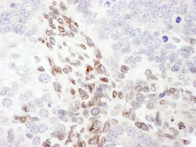LMNA / Lamin A+C Antibody - Detection of Mouse Lamin-A by Immunohistochemistry. Sample: FFPE section of mouse teratoma. Antibody: Affinity purified rabbit anti-Lamin-A used at a dilution of 1:200 (1 ug/ml). Detection: DAB.