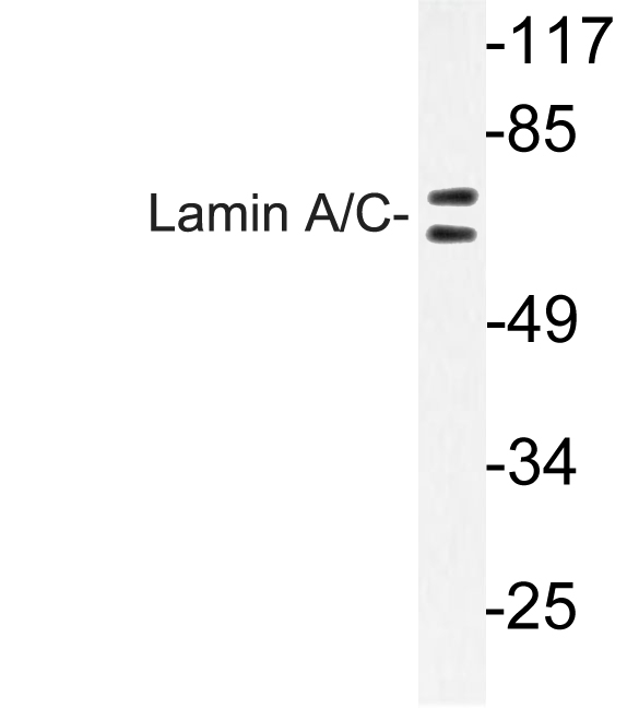 LMNA / Lamin A+C Antibody - Western blot of Lamin A/C (R386) pAb in HeLa cells.