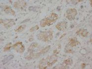 LMNA / Lamin A+C Antibody -  This image was taken for the unconjugated form of this product. Other forms have not been tested.