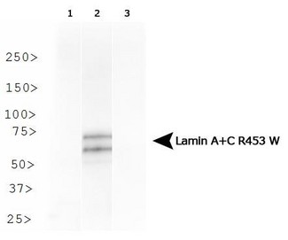 LMNA / Lamin A+C Antibody - Western Blot: Lamin A + C R453W Antibody (12A-2F5) - Analysis of Lamin A + C R453W in HeLa cells transfected with Flag-tagged Lamin A 1) wild type, 2) R453W and 3) R482W.  This image was taken for the unconjugated form of this product. Other forms have not been tested.