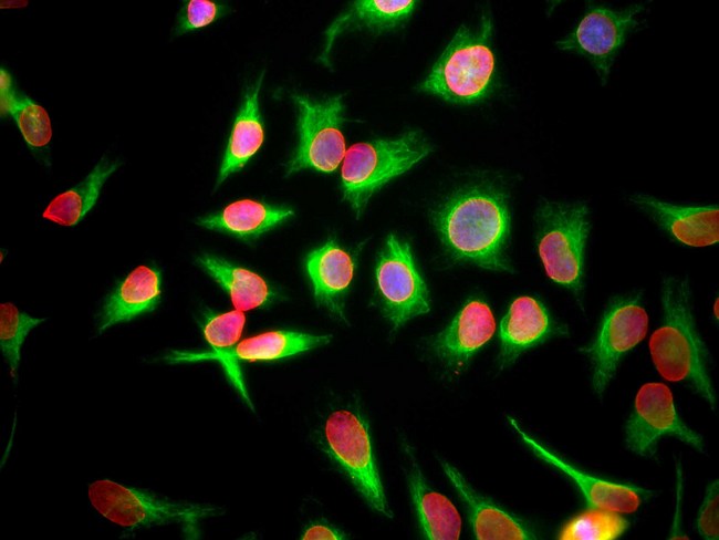 LMNA / Lamin A+C Antibody - HeLa cells staining with LMNA / Lamin A/C antibody (red), and counterstained with chicken polyclonal antibody to Vimentin Vim (green) and DNA (blue). The LMNA / Lamin A/C antibody antibody reveals strong nuclear lamina staining, while the Vimentin antibody reveals cytoplasmic intermediate filaments.