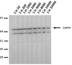LMNA / Lamin A+C Antibody - HeLa lysate run on 4-12% Bis-Tris 2D gel in 1xMOPS running buffer. Transfer to 0.45um nitrocellulose. Membrane probed with 5H8-B4 (anti-Lamin A/C). Anti-mouse IgG (whole molecule)-AP conjugate (1 in 2000). Detection with BCIP/NBT substrate.