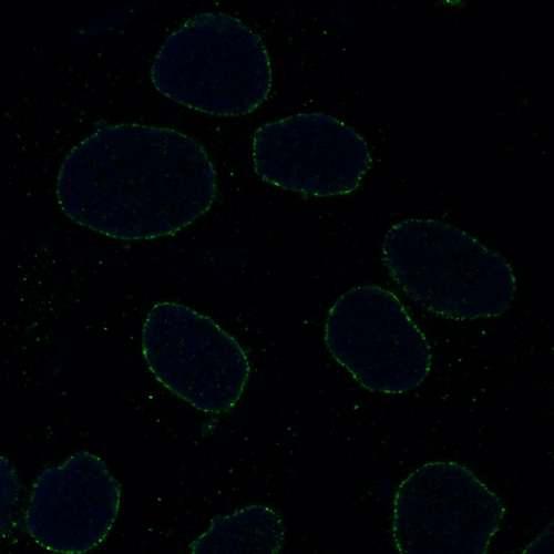 LMNA / Lamin A+C Antibody