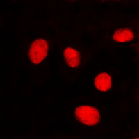 LMNA / Lamin A+C Antibody - Immunofluorescent analysis of Lamin A/C staining in HeLa cells. Formalin-fixed cells were permeabilized with 0.1% Triton X-100 in TBS for 5-10 minutes and blocked with 3% BSA-PBS for 30 minutes at room temperature. Cells were probed with the primary antibody in 3% BSA-PBS and incubated overnight at 4 C in a humidified chamber. Cells were washed with PBST and incubated with a DyLight 594-conjugated secondary antibody (red) in PBS at room temperature in the dark. DAPI was used to stain the cell nuclei (blue).