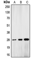 LMNA / Lamin A+C Antibody - Western blot analysis of Lamin A/C expression in HeLa colchicine-treated (A); mouse liver (B); rat kidney (C) whole cell lysates.