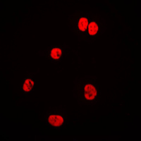 LMNA / Lamin A+C Antibody - Immunofluorescent analysis of Lamin A/C staining in HeLa cells. Formalin-fixed cells were permeabilized with 0.1% Triton X-100 in TBS for 5-10 minutes and blocked with 3% BSA-PBS for 30 minutes at room temperature. Cells were probed with the primary antibody in 3% BSA-PBS and incubated overnight at 4 C in a humidified chamber. Cells were washed with PBST and incubated with a DyLight 594-conjugated secondary antibody (red) in PBS at room temperature in the dark. DAPI was used to stain the cell nuclei (blue).