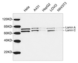 LMNA / Lamin A+C Antibody - Western blot of cell lysates using 1 ug/ml Rabbit Anti-Lamin A+C Polyclonal Antibody. The signal was developed with IRDye 800 Conjugated Goat Anti-Rabbit IgG. Predicted Size: Lamin A 71 KD Lamin C 65 KD. Observed Size: Lamin A 71 KD Lamin C 65 KD.