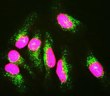 LMNA / Lamin A+C Antibody - HeLa cells staining with LMNA / Lamin A/C antibody (red), and counterstained with 6E2 monoclonal antibody to Lysosomal Associated Membrane Protein 1 (Lamp1, green) and DNA (blue). The LMNA / Lamin A/C antibody antibody reveals strong nuclear lamina staining, while MCA-6E2 antibody reveals strong cytoplasmic punctate staining of lysosomes and early endosomes. Since both DNA (blue) and Lamin A/C (red) are associated with the nuclear compartment, this region appears crimson in this image.