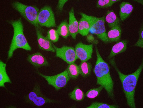 LMNA / Lamin A+C Antibody - HeLa cells staining with LMNA / Lamin A/C antibody (red) counterstained with monoclonal antibody to HSP27, 6H11 (green) and DNA (blue). The LMNA / Lamin A/C antibody antibody reveals strong nuclear lamina staining, while the MCA-6H11 antibody reveals strong cytoplasmic staining. Since both DNA (blue) and Lamin A/C (red) are associated with the nuclear compartment, this region appears crimson in this image.