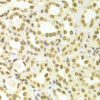 LMNA / Lamin A+C Antibody - Immunohistochemistry of paraffin-embedded Human kidney using Lamin A/C antibodyat dilution of 1:100 (40x lens).