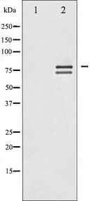LMNA / Lamin A+C Antibody - Western blot analysis of Lamin A/C expression in HeLa whole cells lysates. The lane on the left is treated with the antigen-specific peptide.
