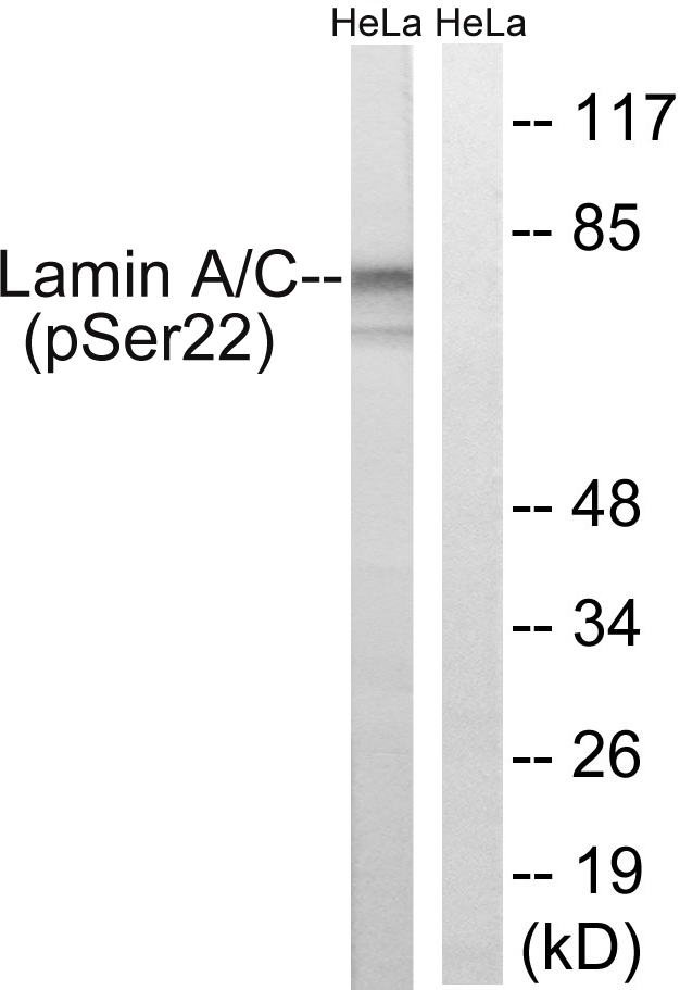 LMNA / Lamin A+C Antibody - Western blot analysis of lysates from HeLa cells treated with paclitaxel 1uM 24h, using Lamin A (Phospho-Ser22) Antibody. The lane on the right is blocked with the phospho peptide.