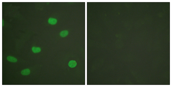 LMNA / Lamin A+C Antibody - Immunofluorescence analysis of HeLa cells, using Lamin A/C (Phospho-Ser392) Antibody. The picture on the right is blocked with the phospho peptide.