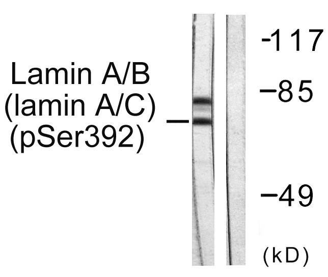 LMNA / Lamin A+C Antibody - Western blot analysis of lysates from HeLa cells, using Lamin A/C (Phospho-Ser392) Antibody. The lane on the right is blocked with the phospho peptide.